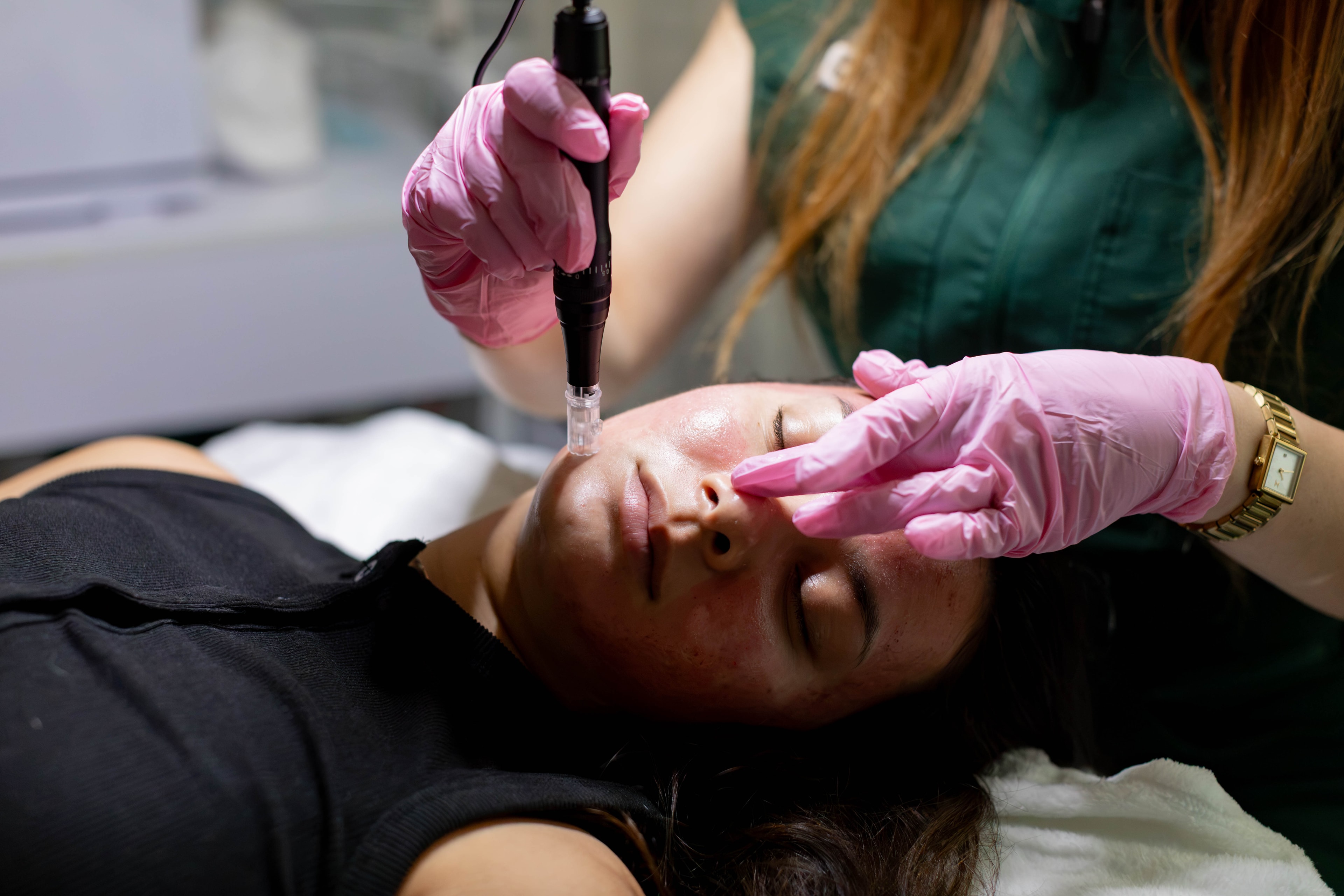 Required Cosmetic Laser Certification + Micro-needling Pen, RF Micro-needling & Dermaplaning. Learn  proven income producing protocols  
 (2-Day) $1499