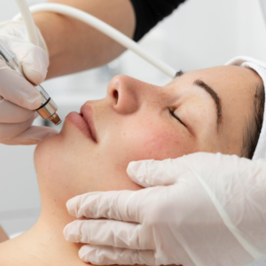 microneedling course in Cumming, GA with microneedling pen